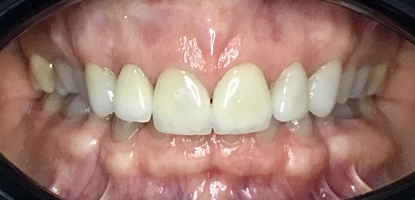 Before Image