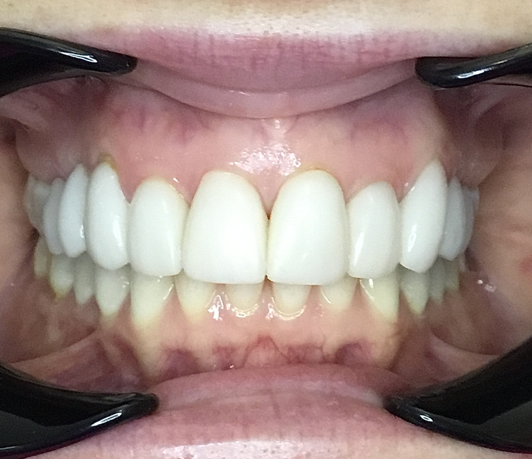 Before Image