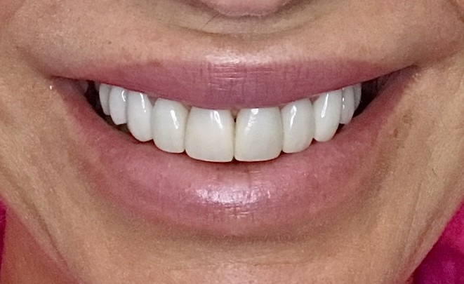 Before Image