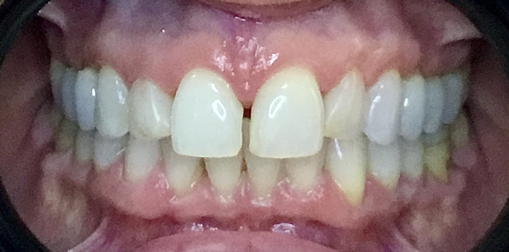 Before Image