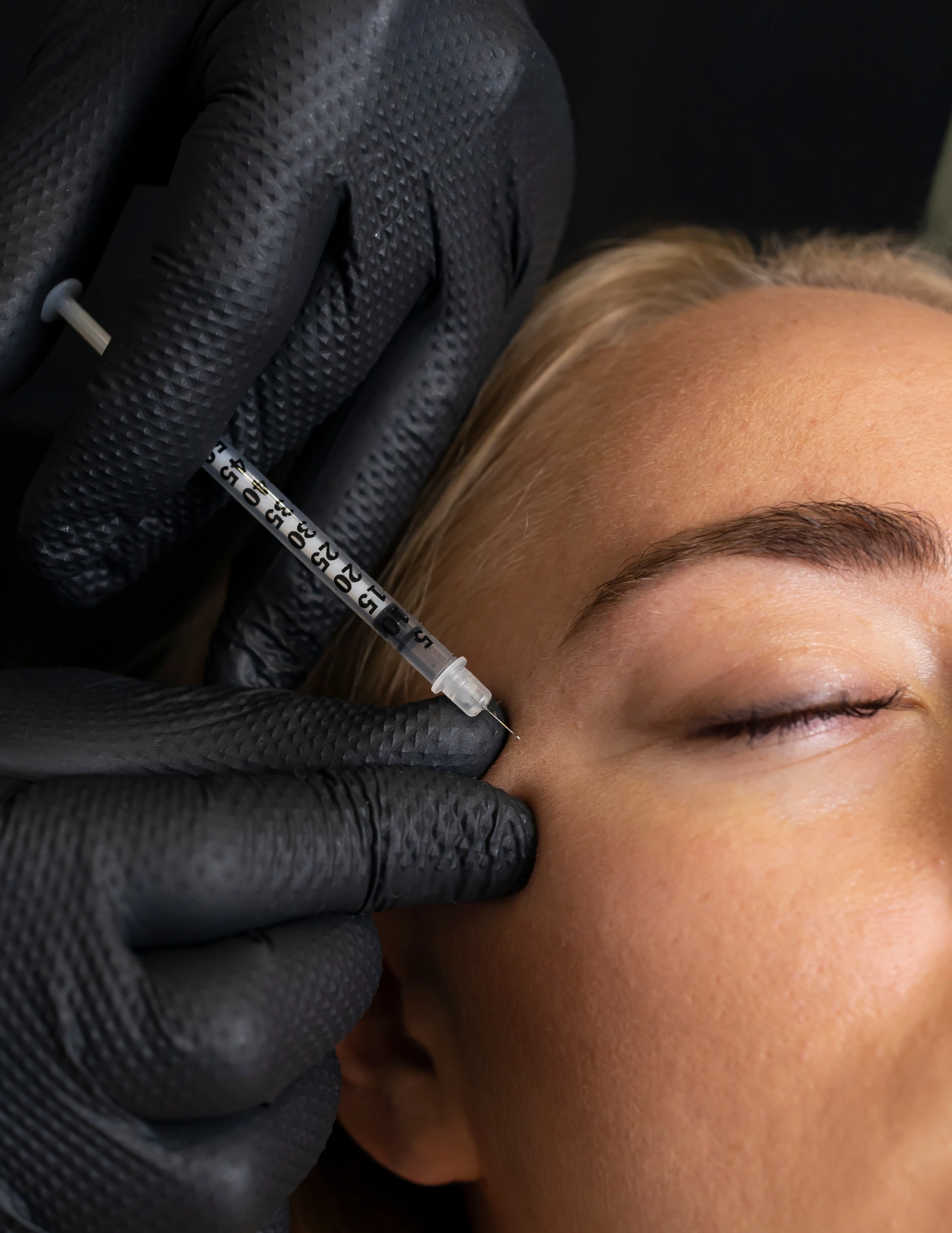 Botox naples fl