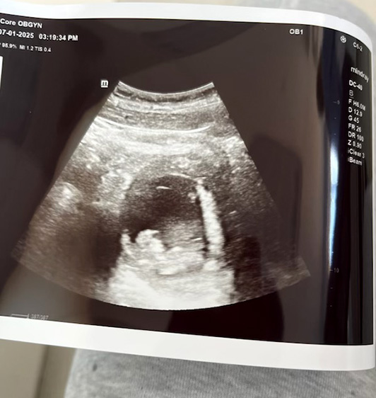 Sonogram