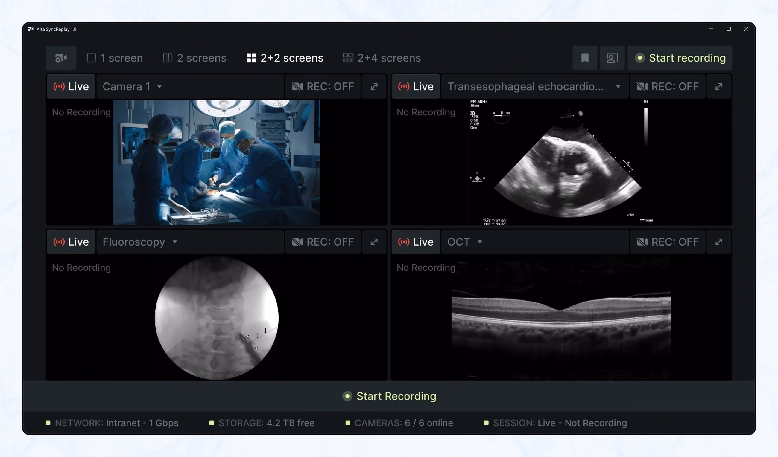 2+2 screens with live and star recording modes