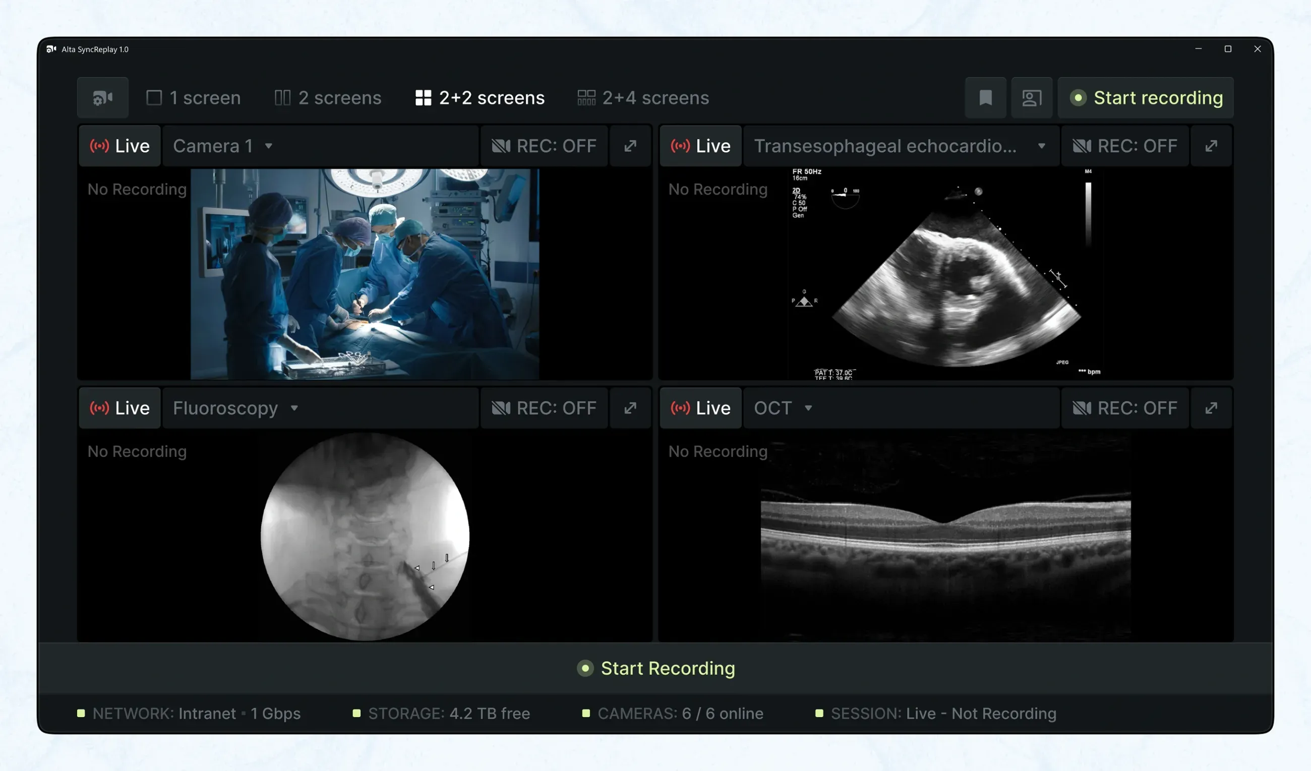 2+2 screens with live and star recording modes