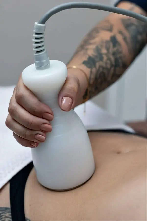 Praticien tenant un applicateur blanc lors d'un traitement de cryolipolyse sur l'abdomen d'une cliente.