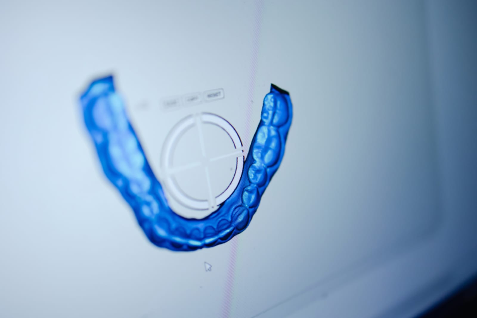 Blue dental veneer model showing shade and shape customization
