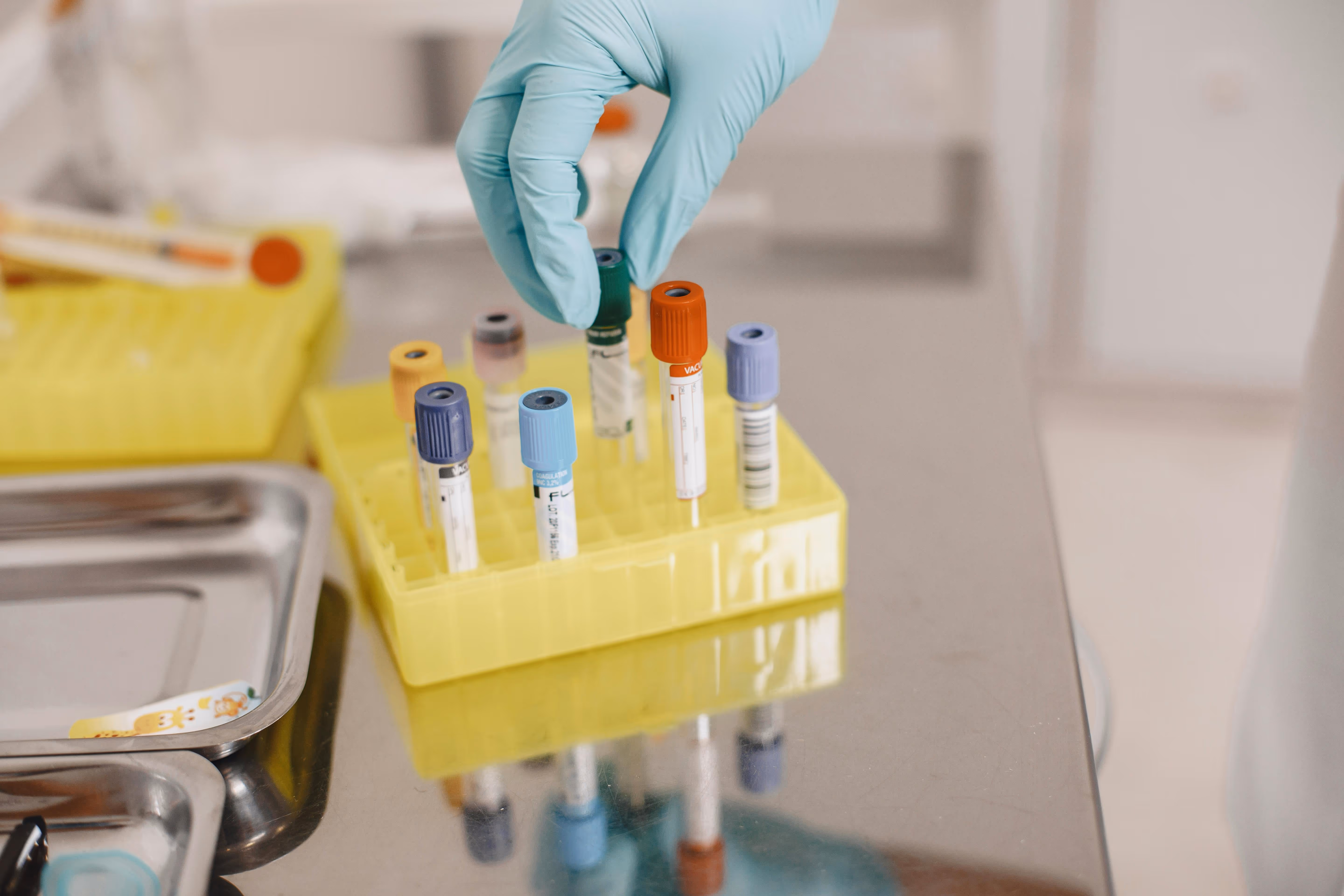 Gloved hand picking a green-capped test tube from a yellow rack with various blood sample tubes in a lab setting.