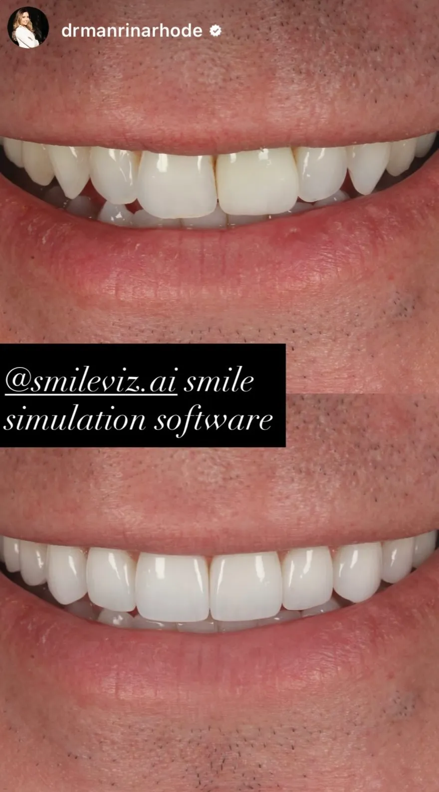 Cosmetic dentist using SmileViz AI smile simulation chairside