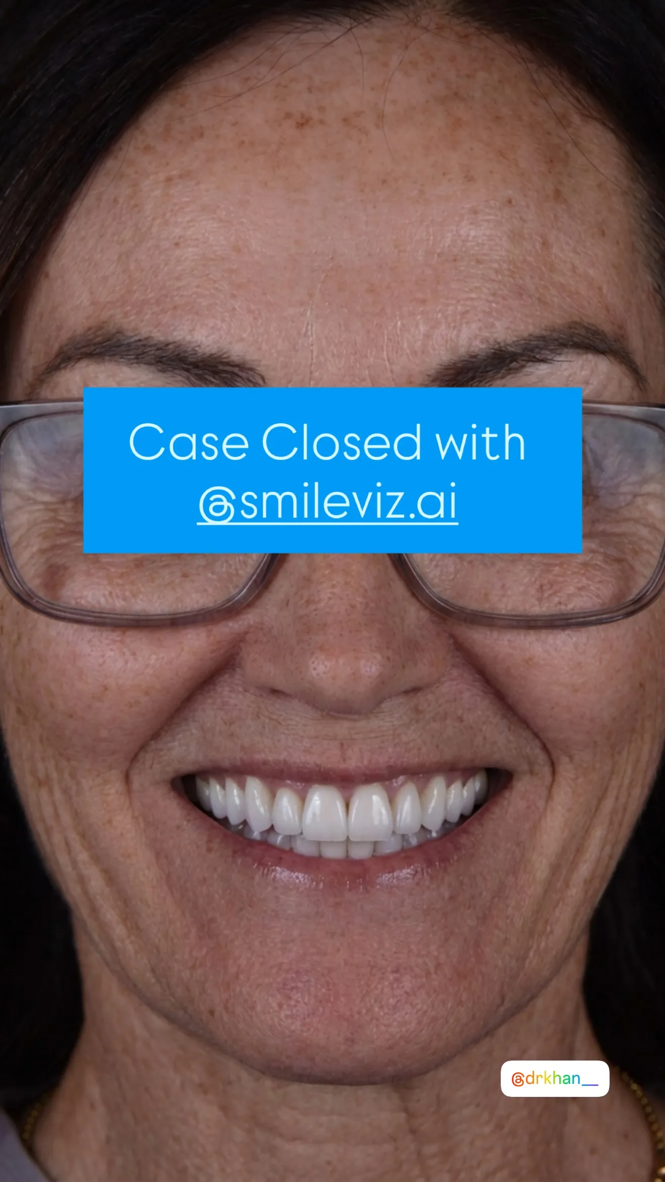 Dentist showing a patient their future smile with SmileViz