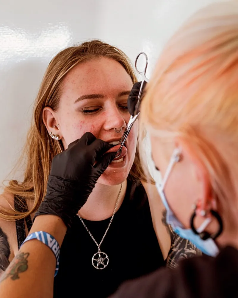 kielilävistys hoito-ohje