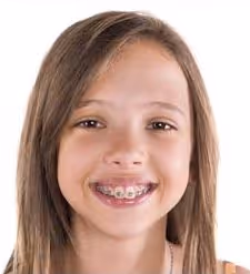 L’enfance, les dents et l’ orthodontie précoce