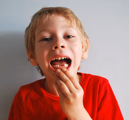 L’agénésie dentaire - qu'est-ce que c'est ?