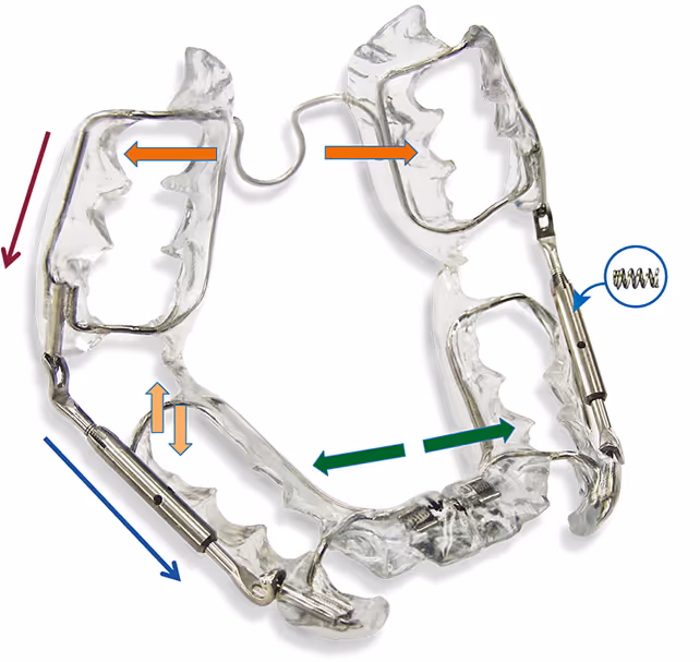 Les avantages du PUL (Propulseur universal Light)