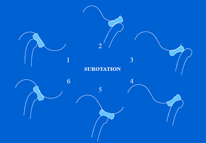 Analyse des tests fonctionnels et diagnostic des troubles de l'appareil temporomandibulaire (ATM) : partie 3