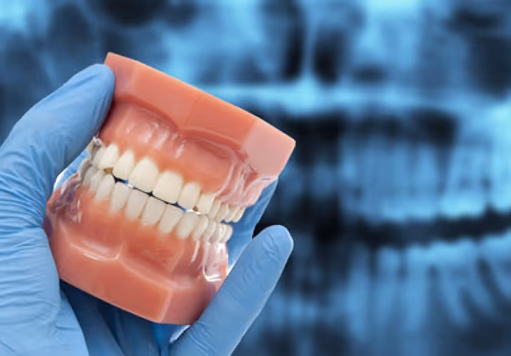 Le montage sur articulateur : un outil essentiel pour l'étude de l'occlusion