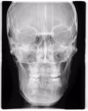 Téléradiographie de face 06