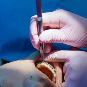 Journée de démonstration clinique présentée par le Docteur Philippe COLLARD