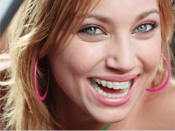 Comment bien se laver les dents avec un appareil dentaire ?