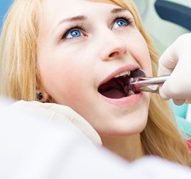 Quand faut-il avoir recours à des extractions dentaires ? Quand faut-il avoir recours à des extractions dentaires ?