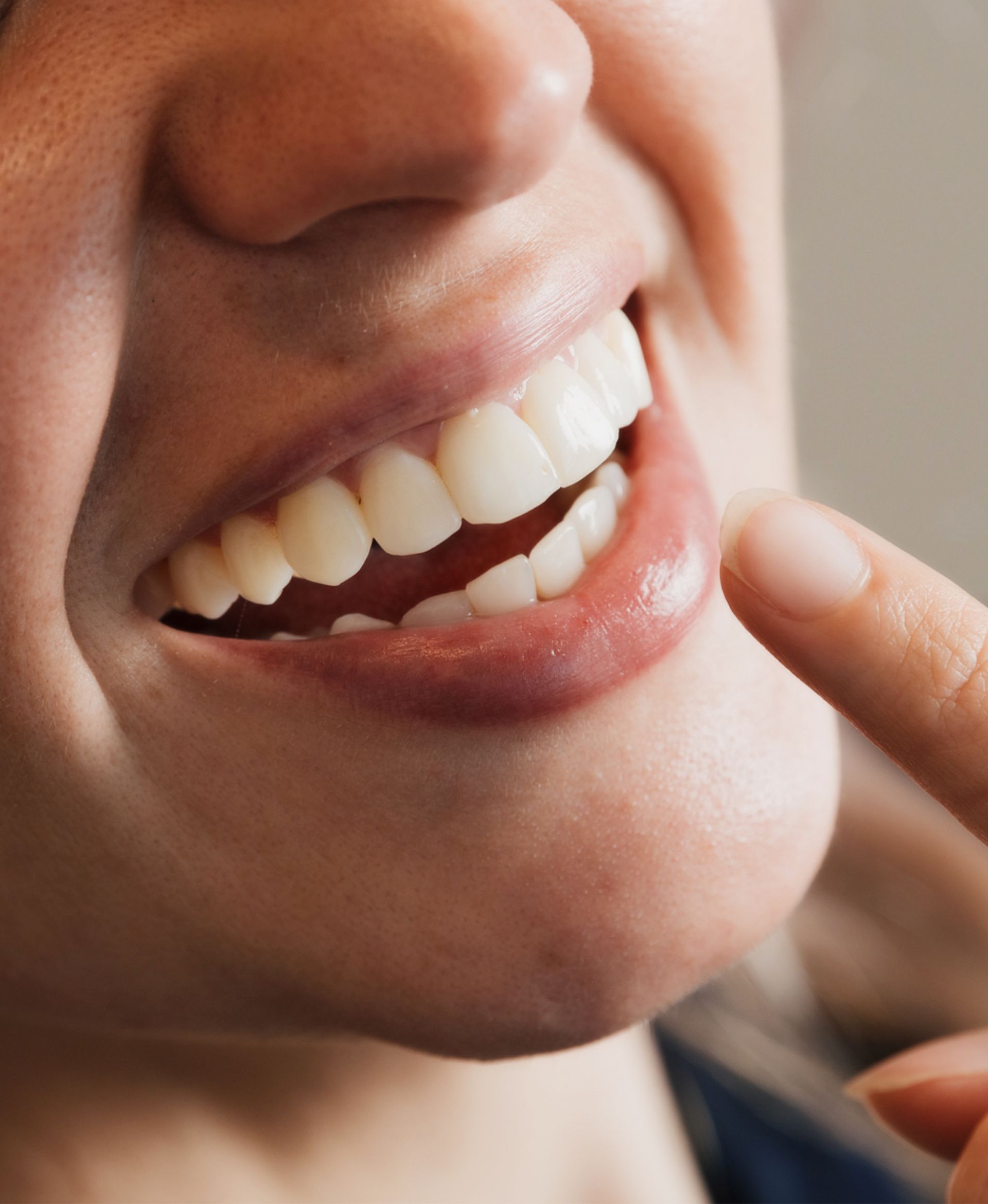 Close-up of a person smiling with white teeth, pointing a finger at their mouth.