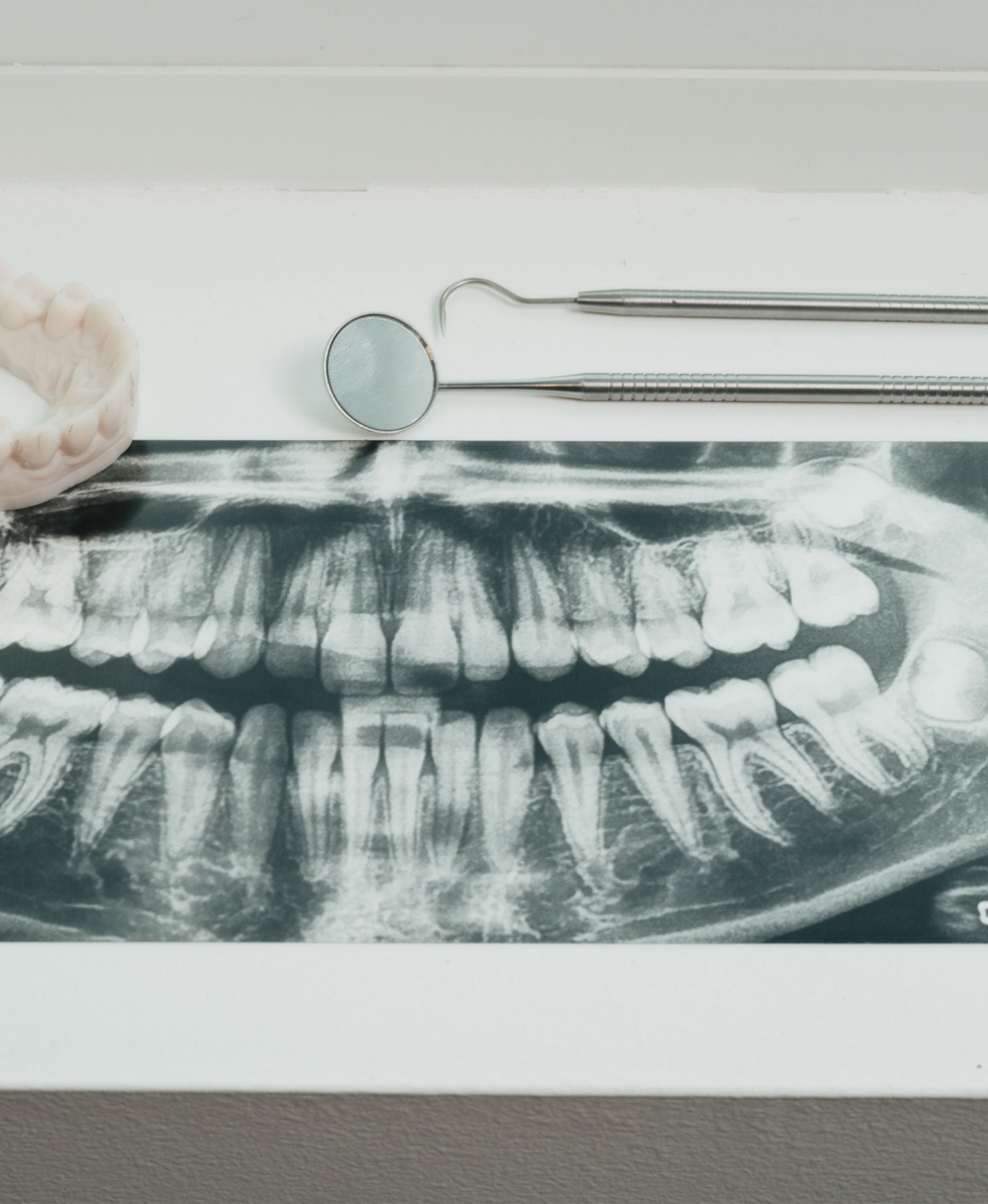 Dental X-ray showing upper and lower teeth with dental mirror and explorer tools on a white surface.