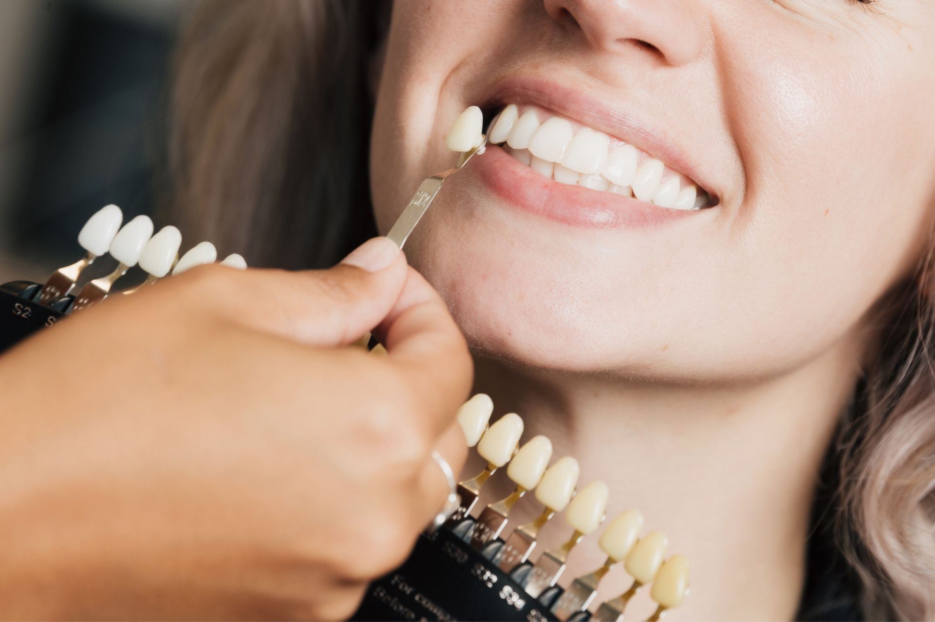 Dentist comparing tooth shade guide to a patient's white teeth for color matching.