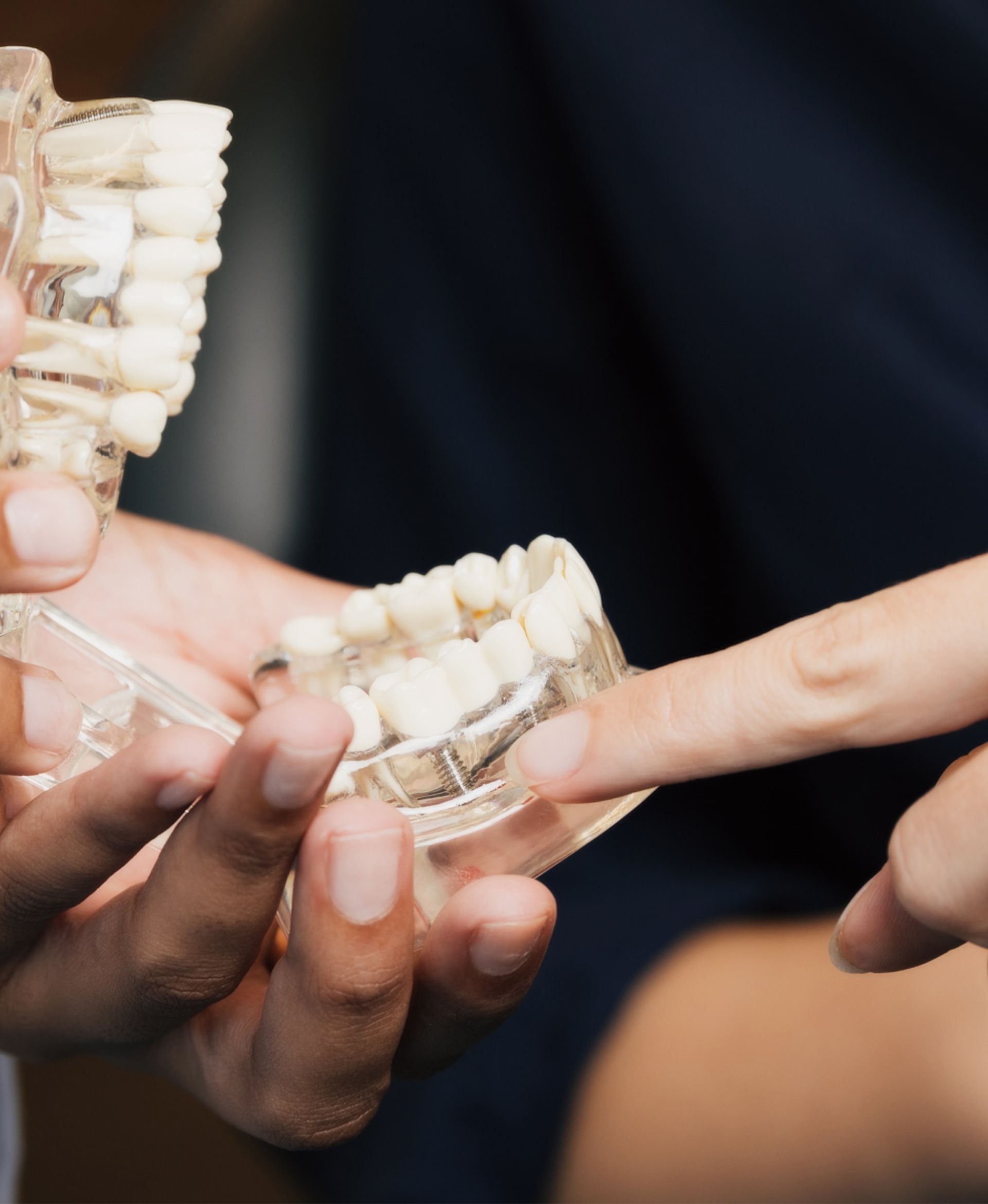 Hands holding and pointing at a transparent dental jaw model showing teeth and an implant.