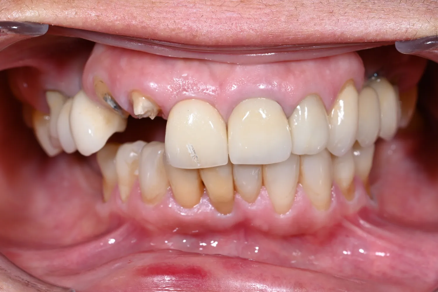 Before Image
