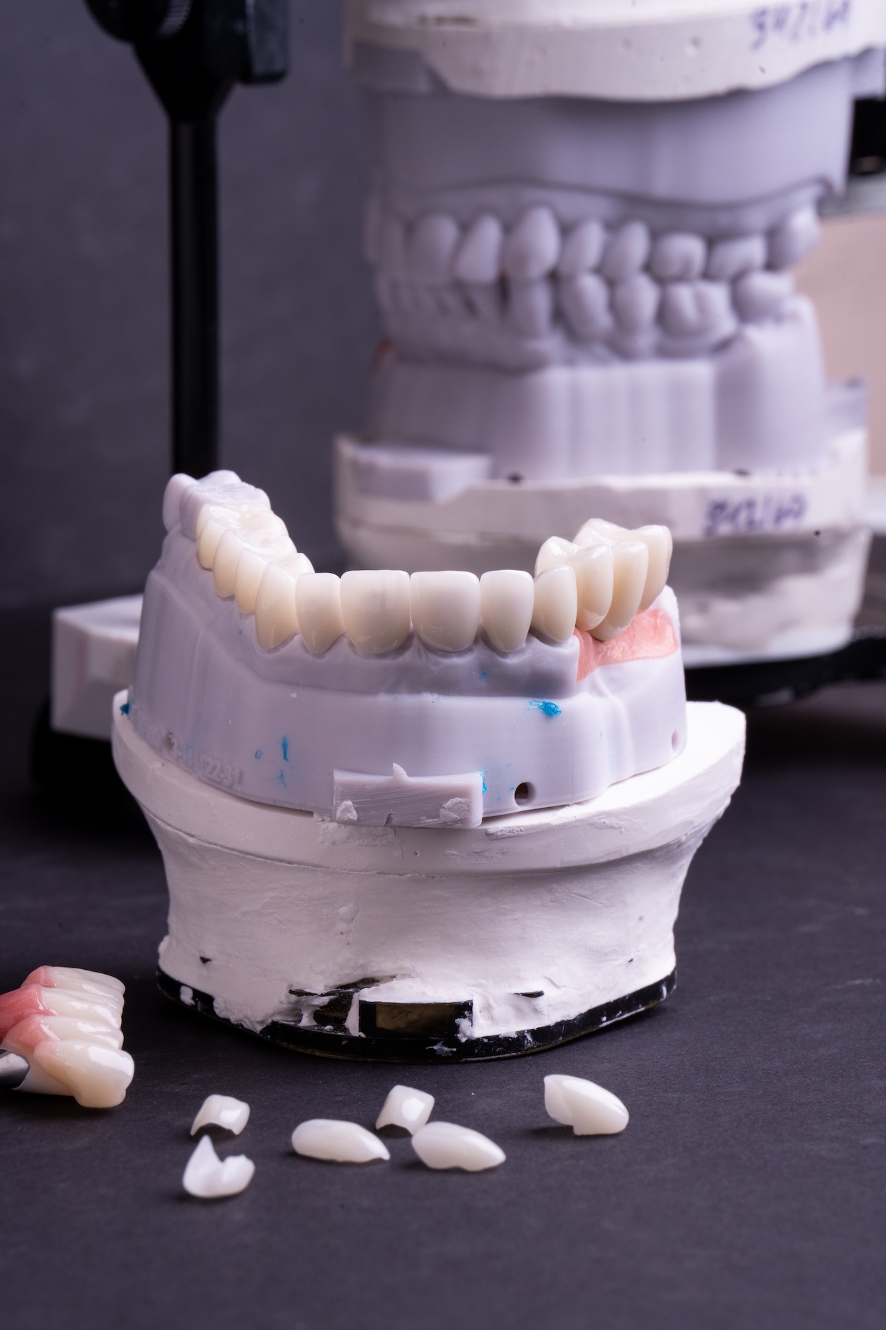 Restorative Dentistry in Totowa