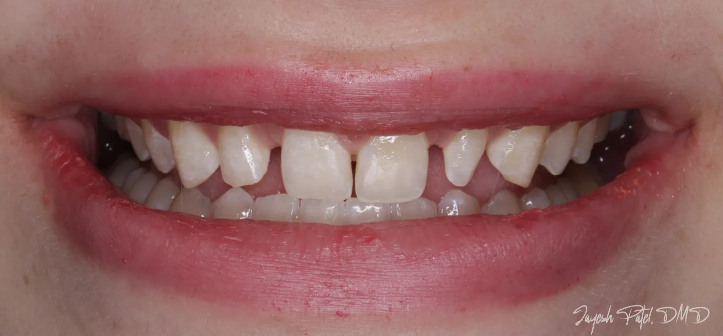 Before Image