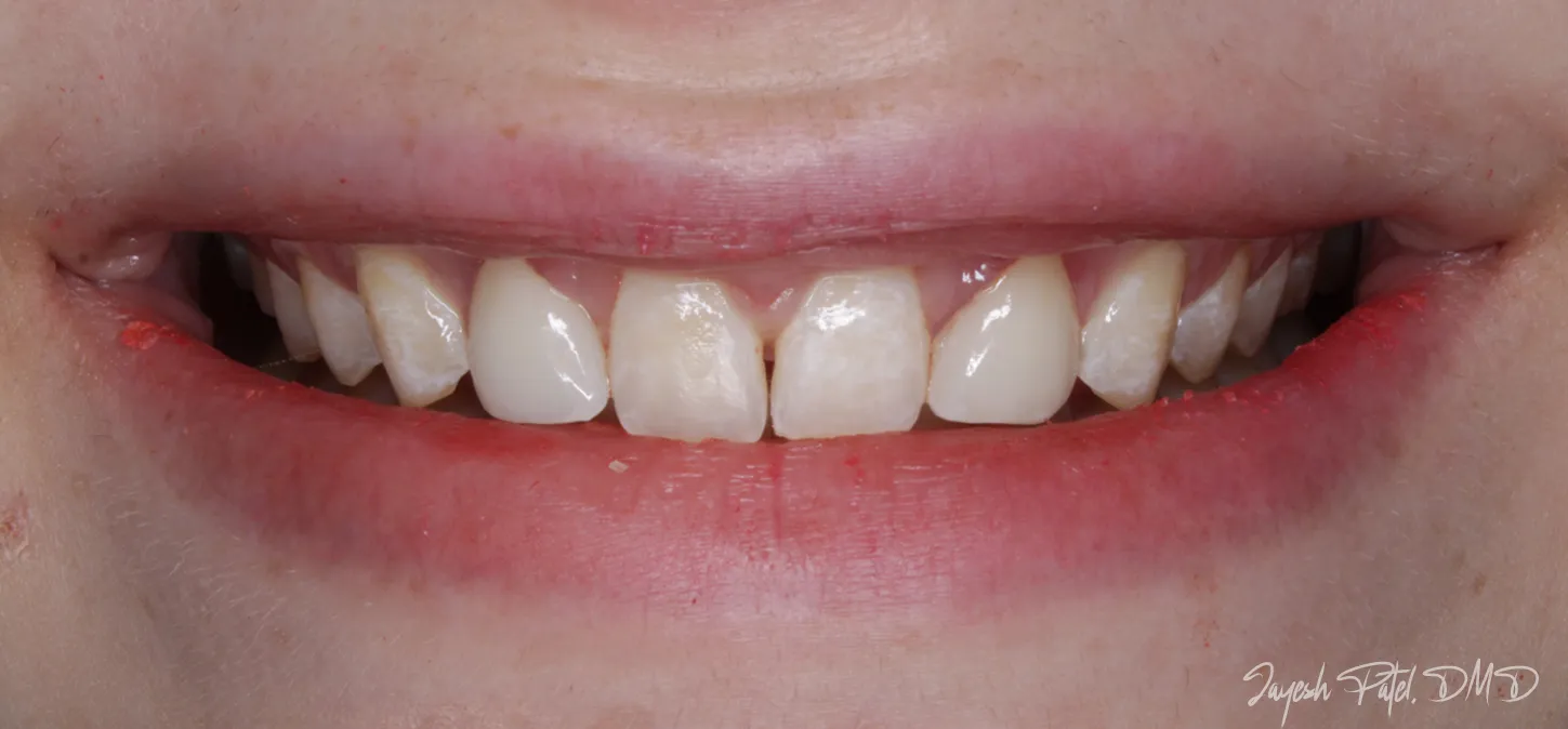 After Image