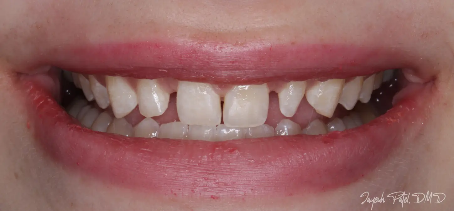 Before Image