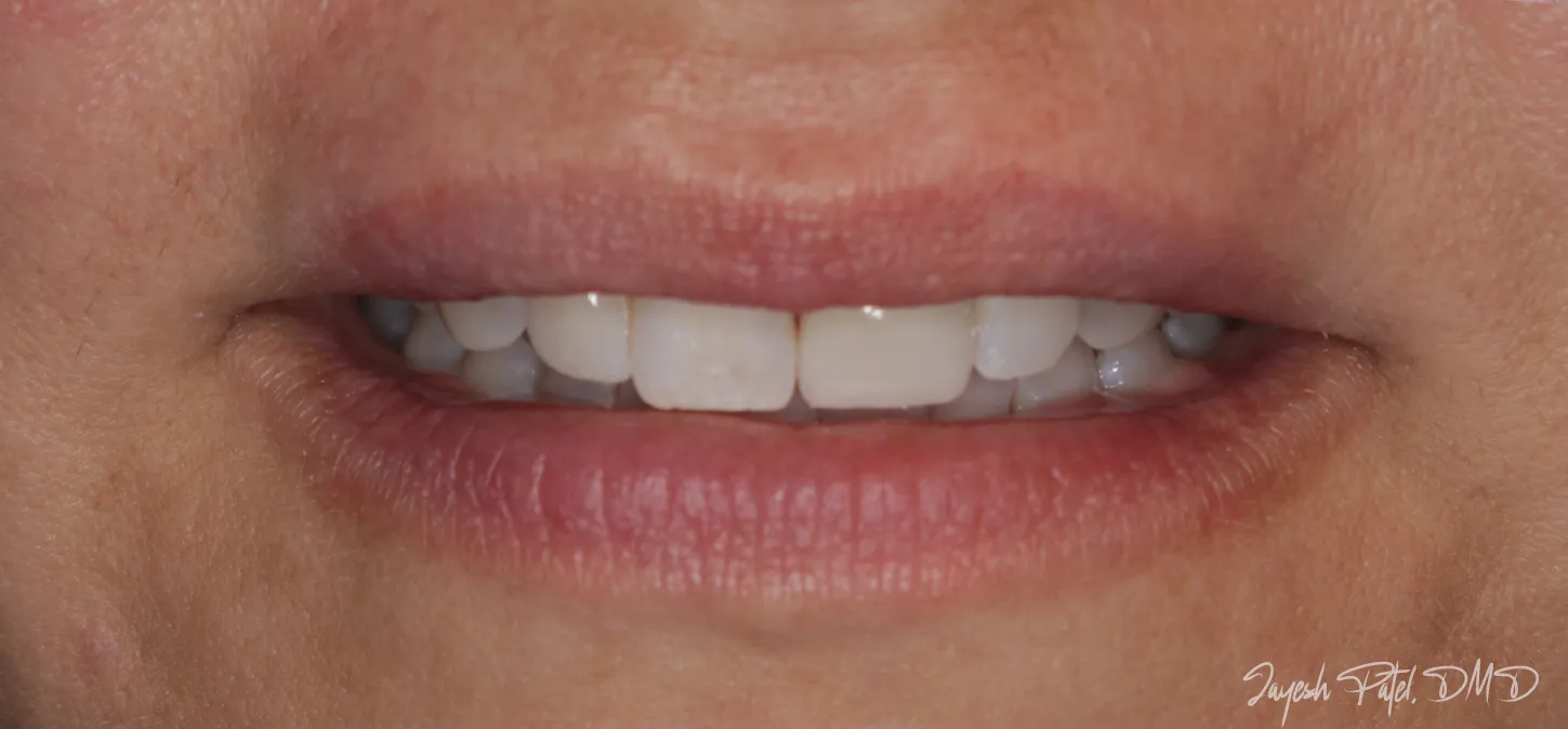 After Image