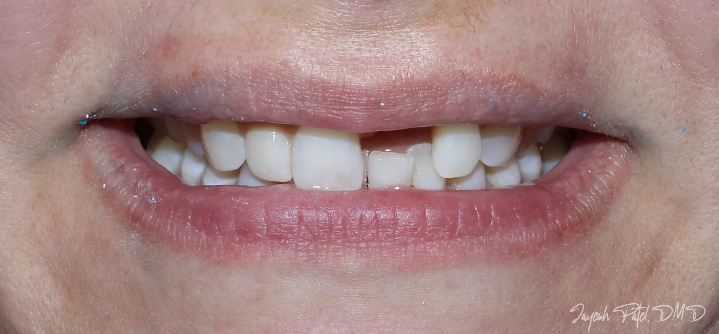 Before Image