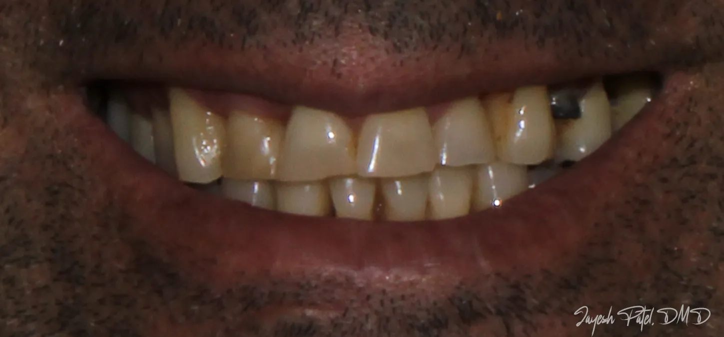 Before Image
