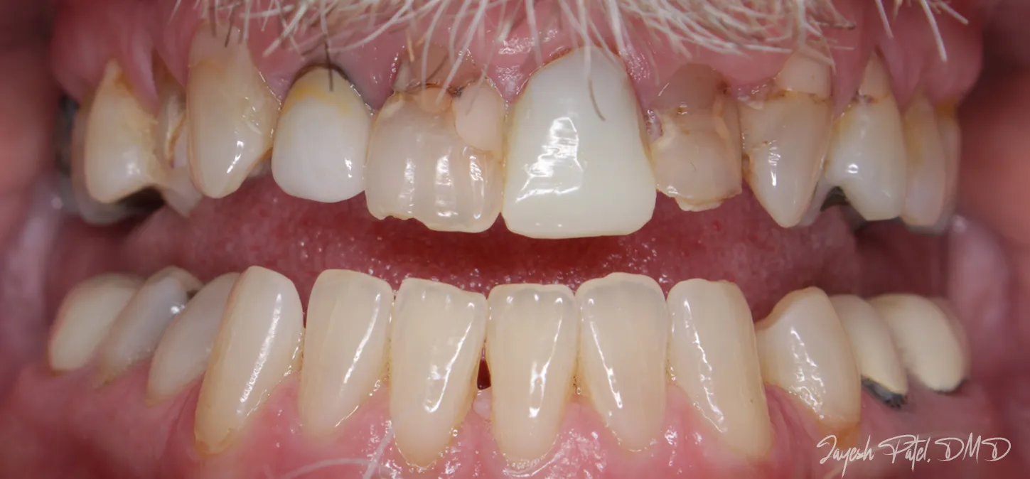 Before Image