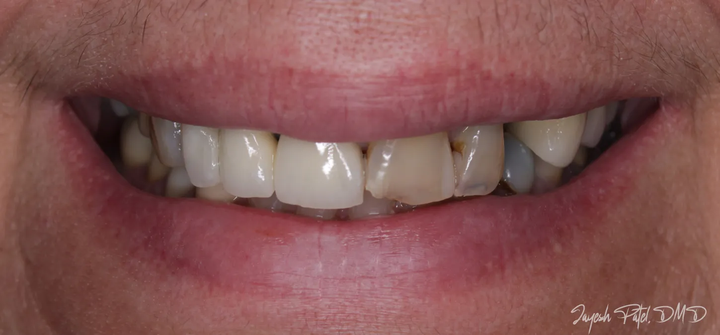 Before Image