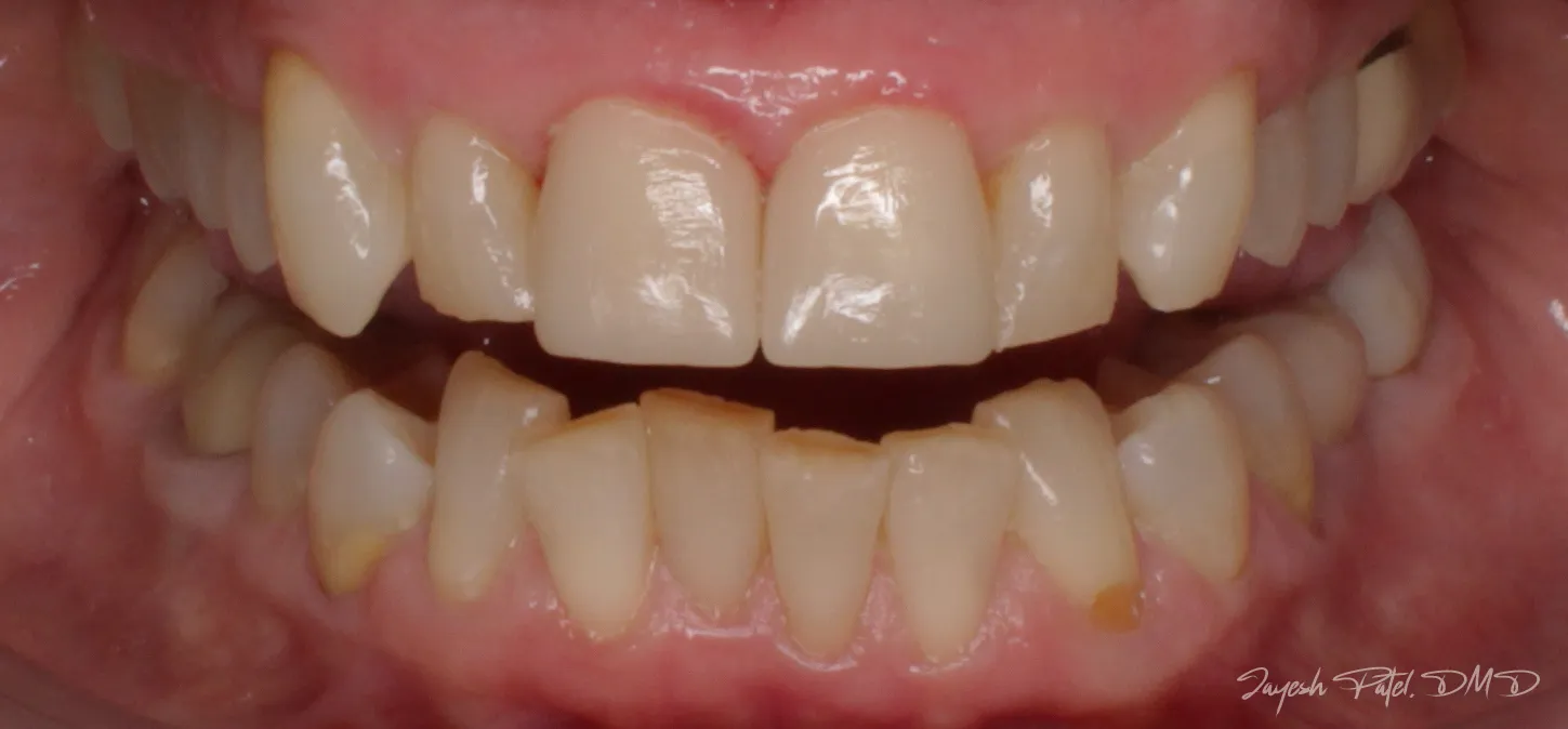 After Image