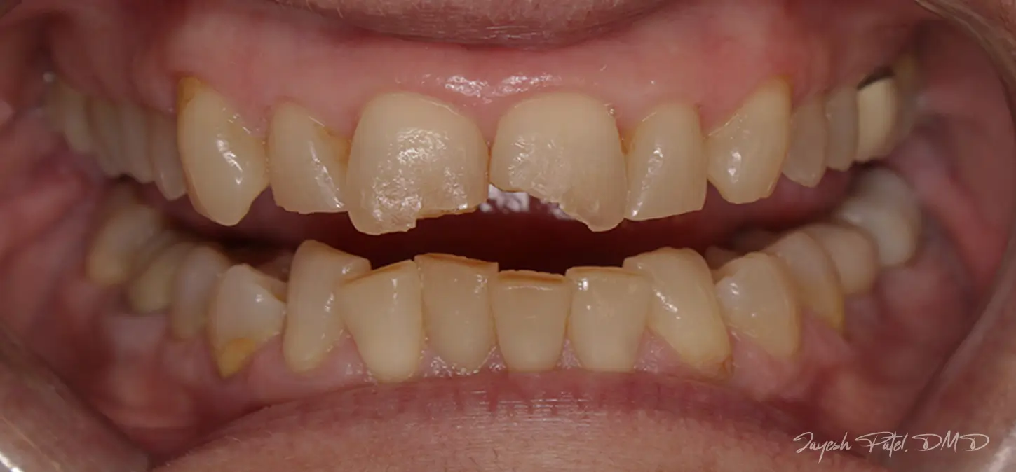 Before Image