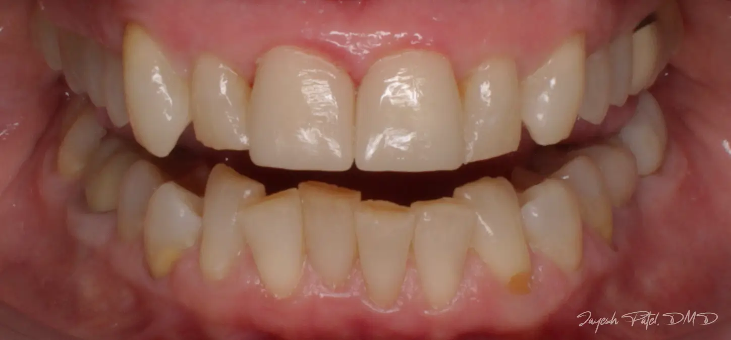 After Image