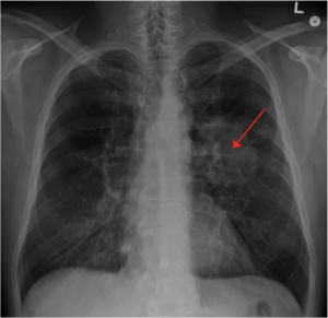 Deadlines in medical malpractice