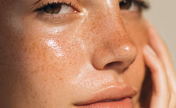 Close-up of a person's freckled face with glistening skin and a hand gently touching the cheek.