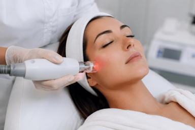Patient receiving laser resurfacing treatment for sun damage and acne scars in Greenwood, Colorado