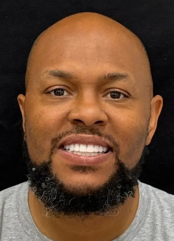 Smiling bald man with a full beard and brown eyes wearing a grey shirt against a black background.