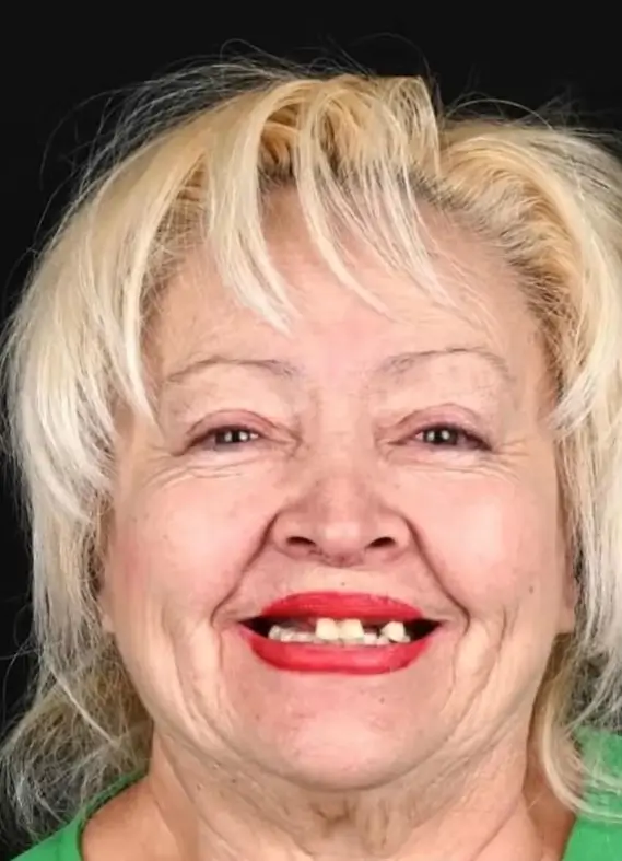 Close-up of an elderly woman with blonde hair smiling, wearing red lipstick and a green top.