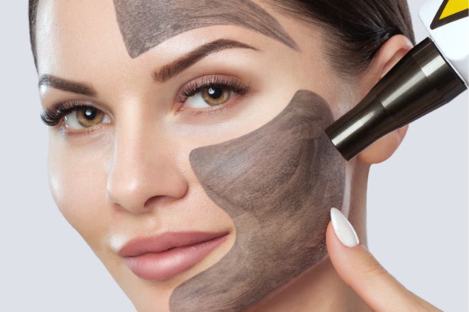 Carbon Laser Behandlung Bonn – Haute Contour
