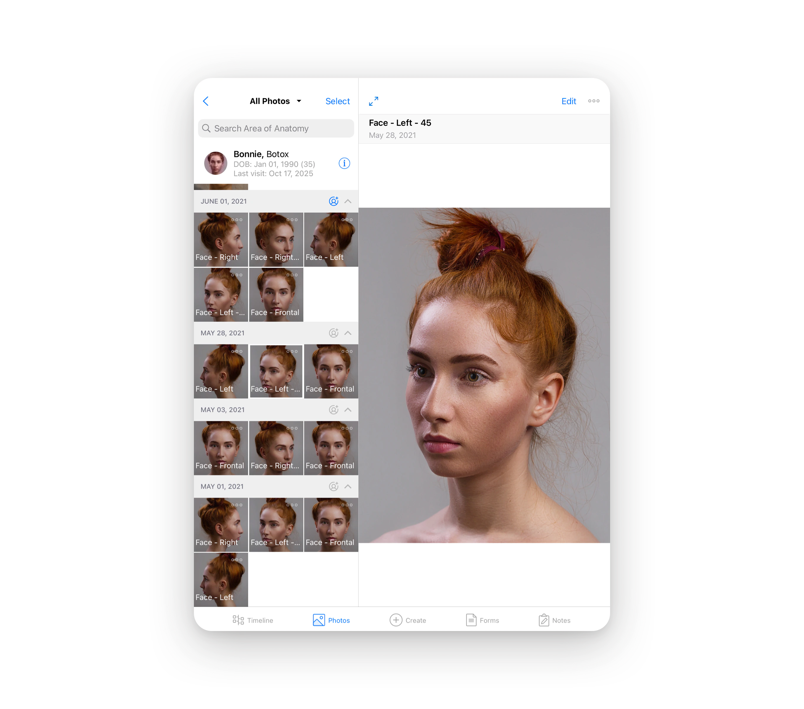 Guided photo capture in the RxPhoto app
