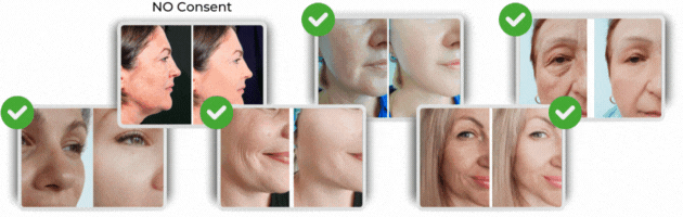 before and after photos