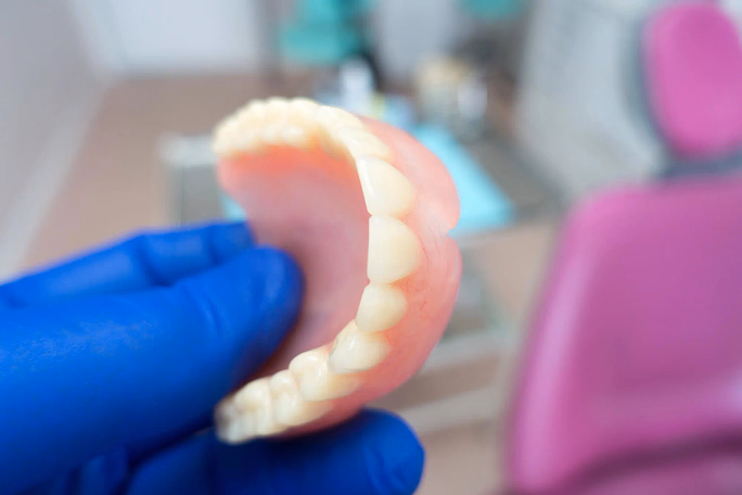 Hand in blue glove holding a set of upper false teeth in a dental clinic setting.