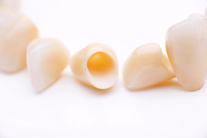 Close-up of several ivory-colored dental crowns, one showing the hollow interior.